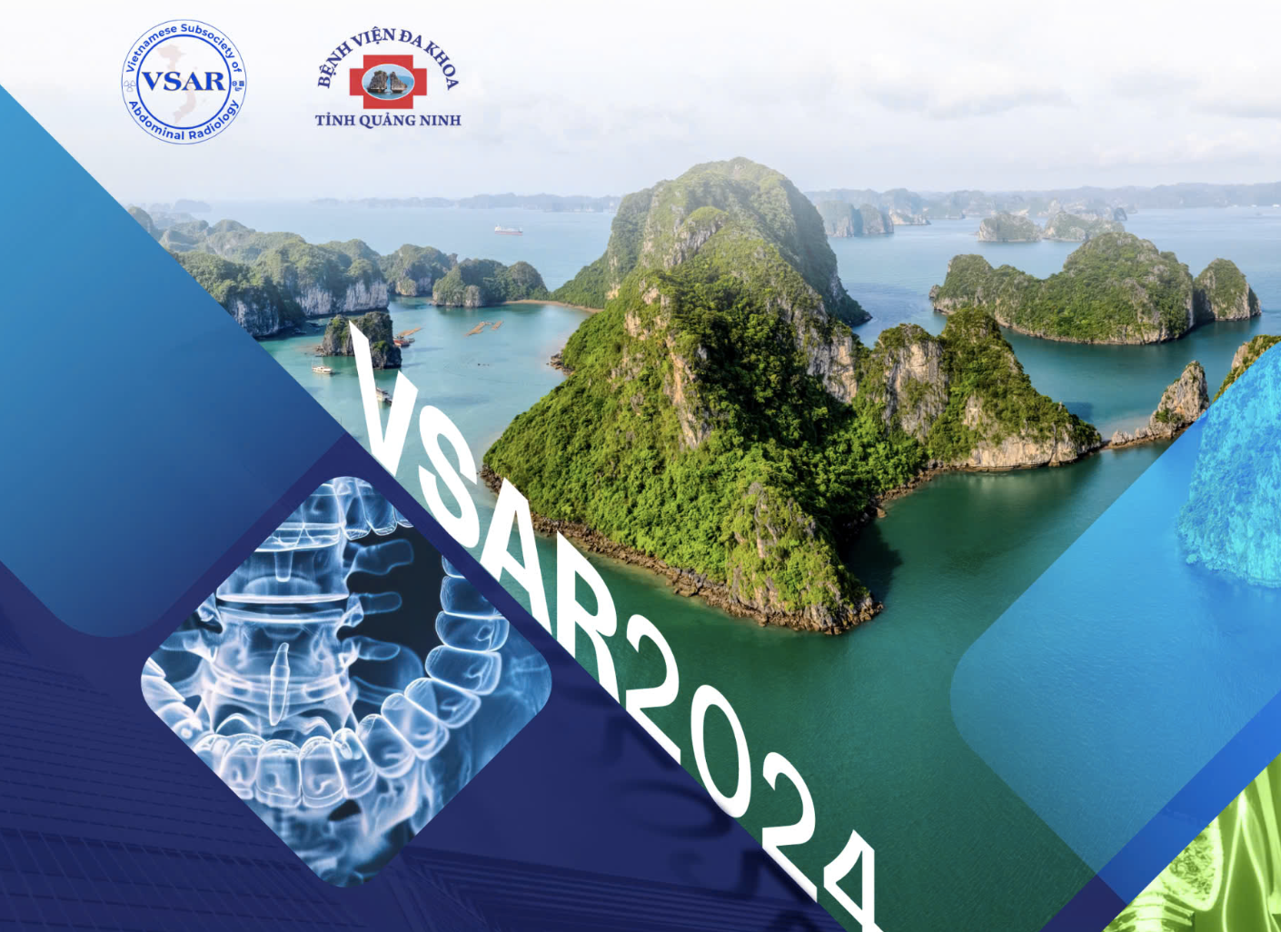 HỘI NGHỊ KHOA HỌC HÌNH ẢNH Ổ BỤNG LẦN THỨ 1