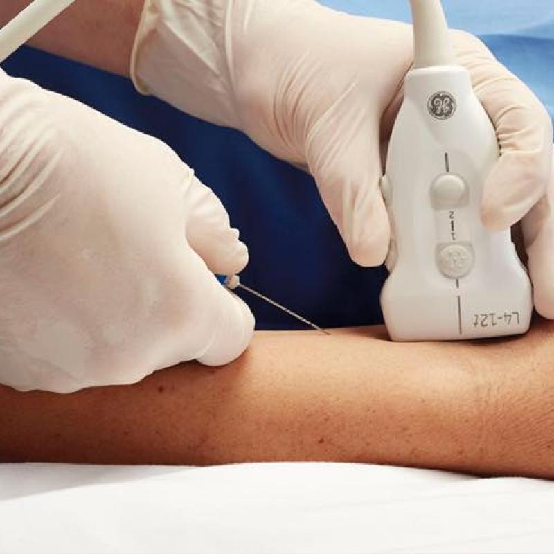 Lớp đào tạo về gây tê vùng: gây tê đường nách, gây tê thần kinh đùi và thần kinh hông dưới hướng dẫn của siêu âm