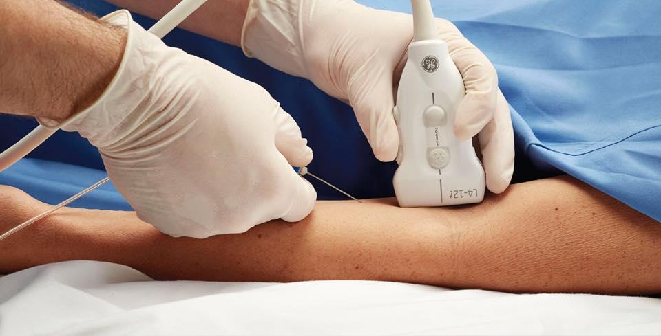 Lớp đào tạo về gây tê vùng: gây tê đường nách, gây tê thần kinh đùi và thần kinh hông dưới hướng dẫn của siêu âm
